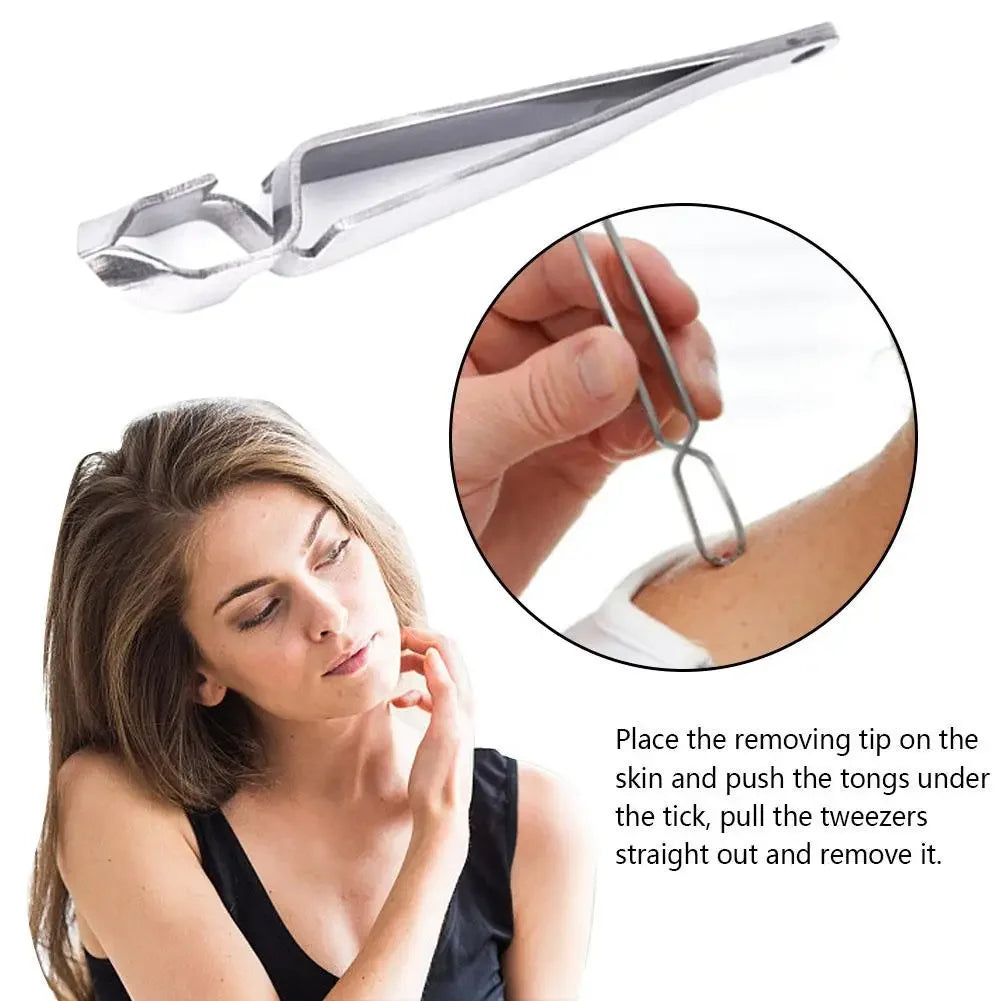 Stainless Steel 2 In 1 Pet Treatment Tick Removal Tool